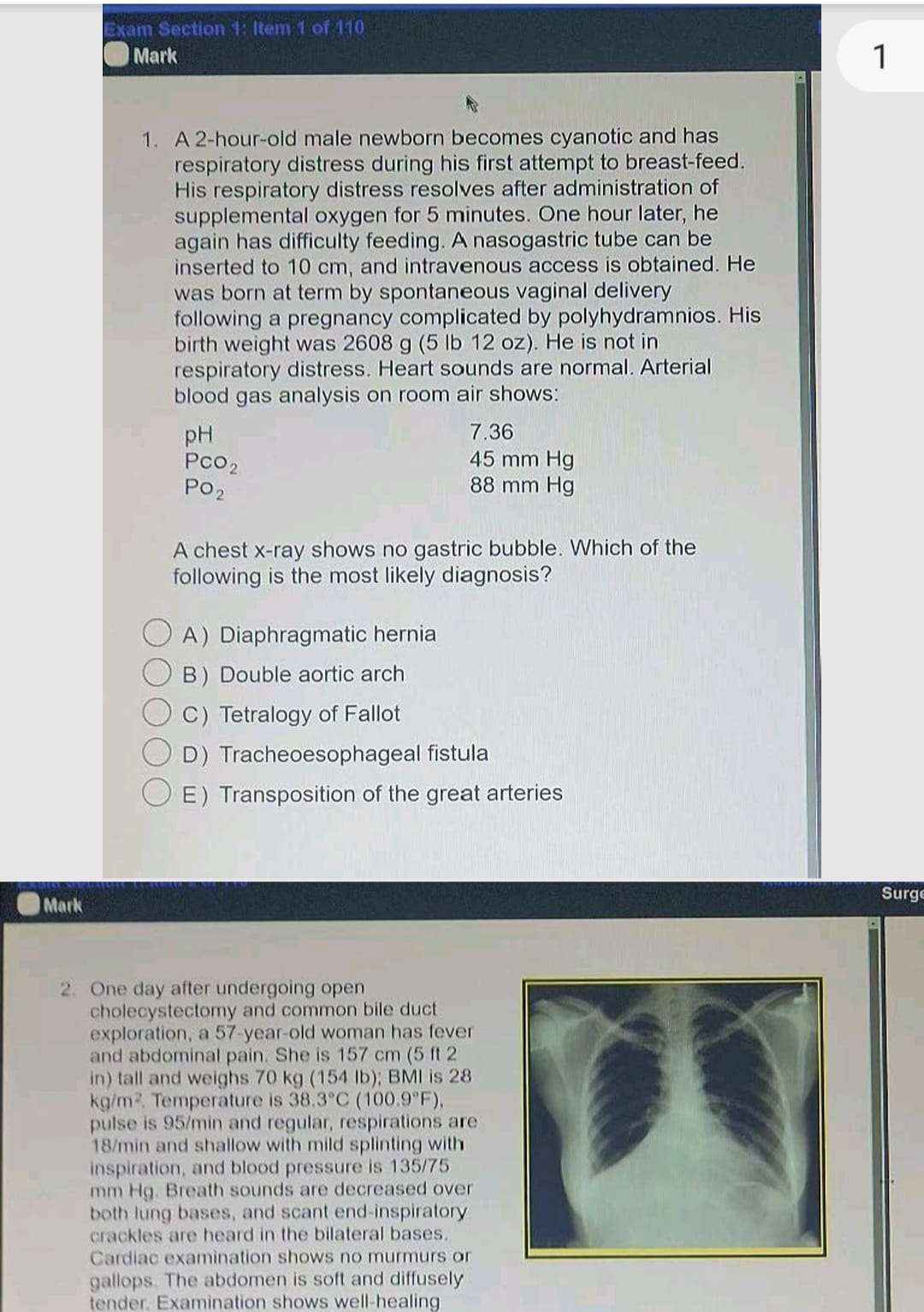 Authentic 2025-2026 Shelf Surgery Clinical Exam Package – Real/Actual/Direct Metric Questions