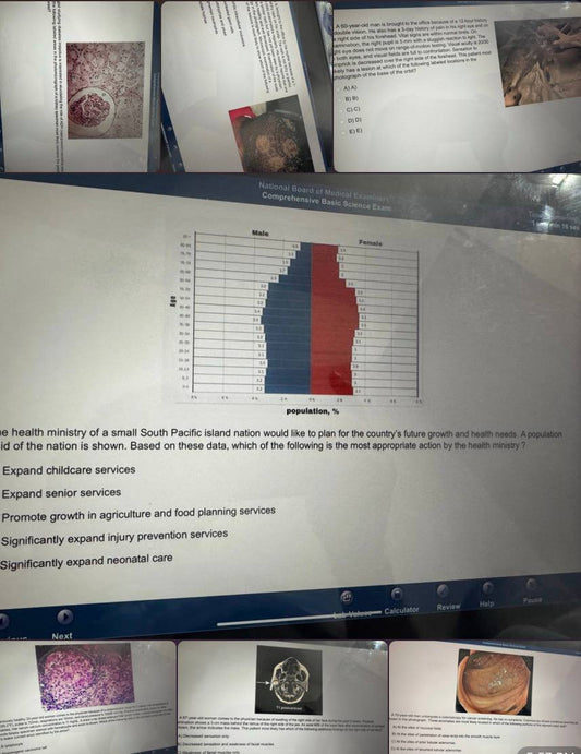 🏆 CBSE NBME Real/Actual Past Papers & Recalls Exam Package – 45+ Files (200 Questions Each) | Updated & High-Yield!